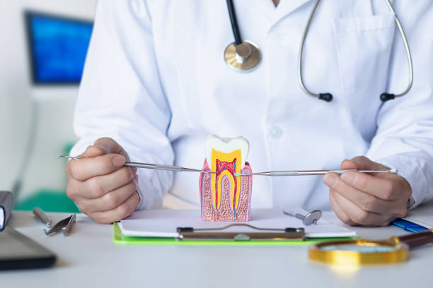 Best Dental Abscess Treatment in Fayetteville, NY